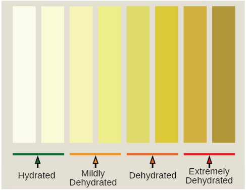 Urine Color